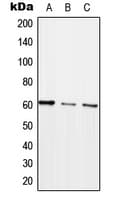 ARHGEF5 Antibody (Internal)