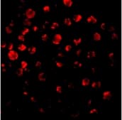 IRAK2 / IRAK-2 Antibody
