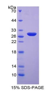 Human P40PHOX / NCF4 Protein (Recombinant His-T7)