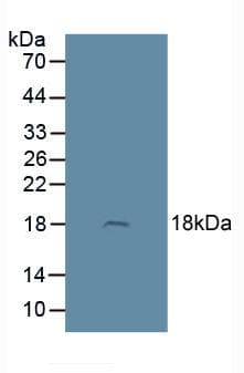 ADM / Adrenomedullin Antibody (aa22-147)