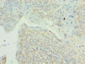 MAPK4 / ERK4 Antibody (aa348-587)
