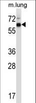 MKNK2 / MNK2 Antibody (aa36-64)