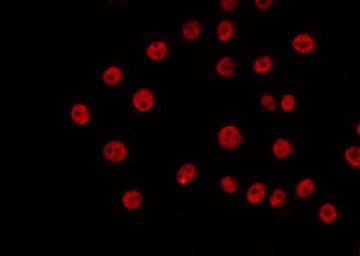 Polyclonal Rabbit anti-Human SENP5 Antibody (IHC, IF, WB)