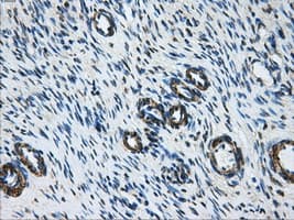 Monoclonal Mouse anti-Human DCXR Antibody (clone OTI7D11, IHC, WB)