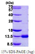 Human DNAL4 / Dynein Light Chain 4 Protein (Recombinant His)