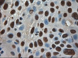 AMY2A / Pancreatic Amylase Antibody (clone OTI6D4)