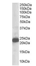 IHC-plus™ SCG10 / STMN2 Antibody (aa2-11)