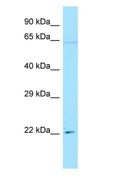 Polyclonal Rabbit anti-Human IFI30 / IP30 Antibody (aa101-150, WB)