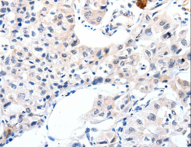 IGFBP7 / TAF Antibody