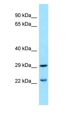 Polyclonal Rabbit anti-Human SLC25A10 / DIC Antibody (aa98-147, WB)