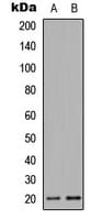 MRPL51 Antibody (Internal)