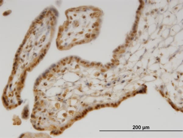 Monoclonal Mouse anti-Human SEPX1 / Selenoprotein R Antibody (clone 8B2, IHC, WB)