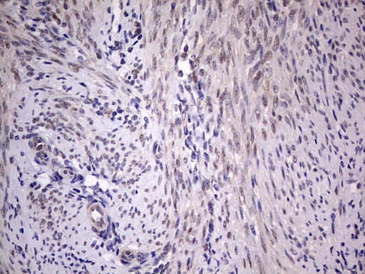 PIK3CA / PI3K Alpha Antibody (aa303-631, clone OTI6D1)