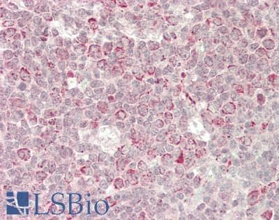 IHC-plus™ DFFA / ICAD / DFF45 Antibody