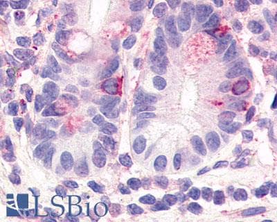 PathPlus™ HNF4G / HNF4 Gamma Antibody (Internal)