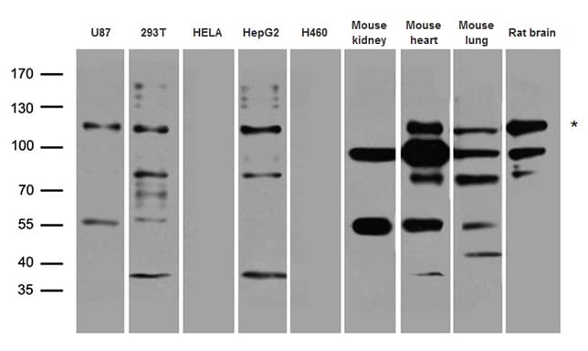 SYNPO / Synaptopodin Antibody