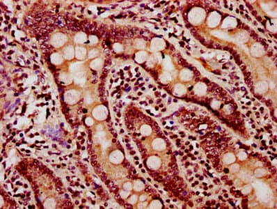 Polyclonal Rabbit anti-Human HIST1H2BN Antibody (IHC, IF)