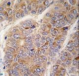 Apolipoprotein A-II Antibody (aa28-56)