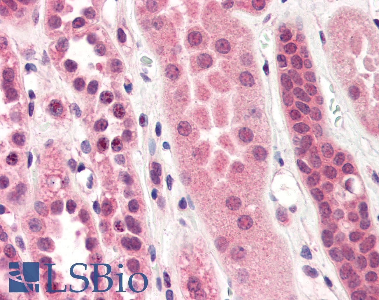 IHC-plus™ Monoclonal Mouse anti-Human STEAP1 / STEAP Antibody (clone J2D2, aa1-70, IHC, IF, WB)