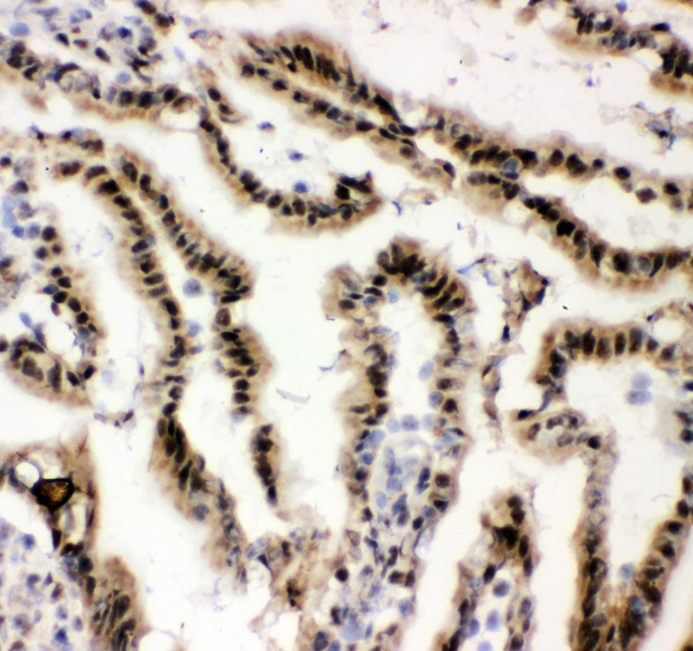 EWSR1 / EWS Antibody (aa369-399)