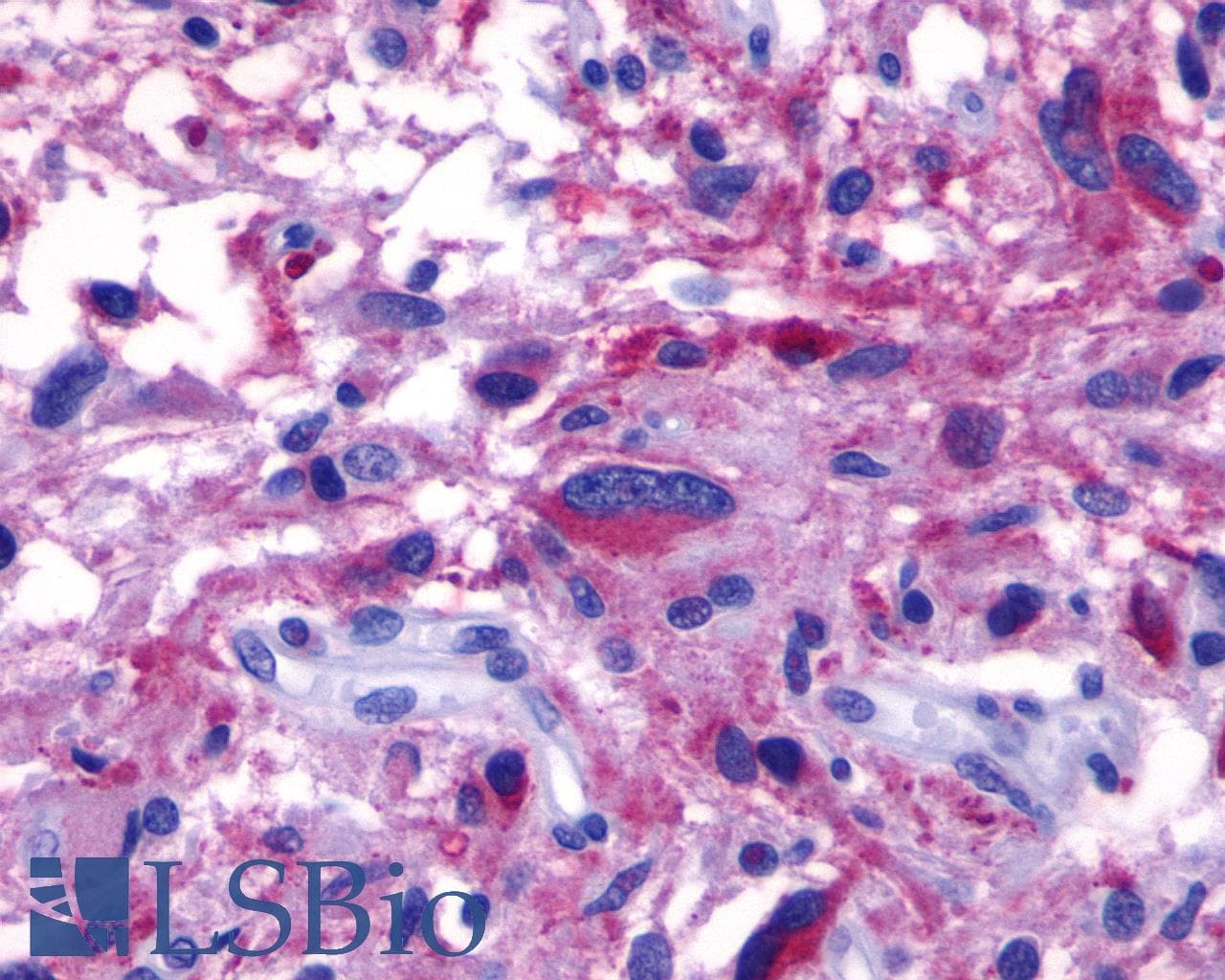 PathPlus™ ADGRF1 / GPR110 Antibody (N-Terminus)