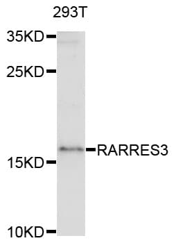 Polyclonal Rabbit anti-Human RARRES3 Antibody (WB)