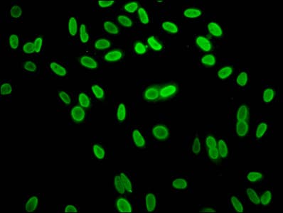HIST1H1C Antibody