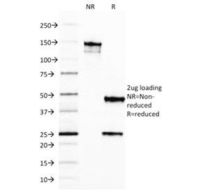 FTL / Ferritin Light Chain Antibody (clone FTL/1387)
