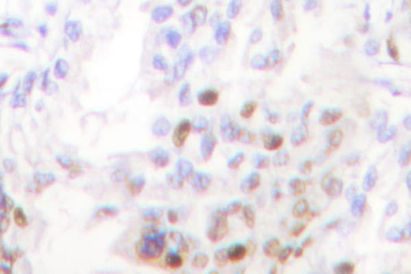 AKT1 + AKT2 + AKT3 Antibody (Ala444)
