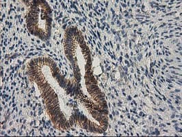 CTNNB1 / Beta Catenin Antibody (clone OTI1E10, Carrier-free)