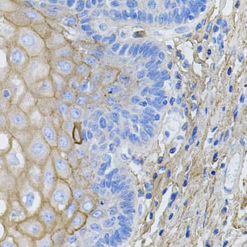 Polyclonal Rabbit anti-Human COL1A1 / Collagen I Alpha 1 Antibody (aa100-200, IHC, WB)