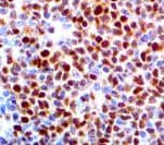 SOX11 Antibody (clone CL0142, Ready-to-Use)
