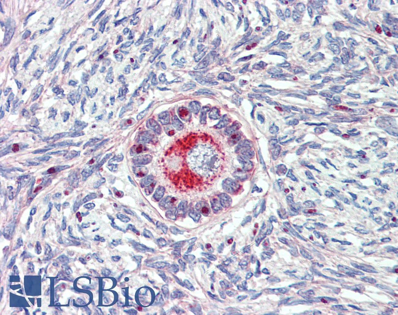 IHC-plus™ Polyclonal Rabbit anti-Human TM9SF1 Antibody (Internal, IHC)