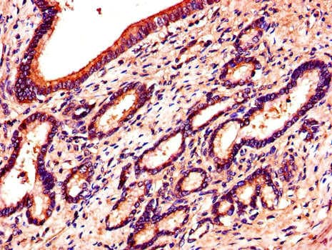 EPHB6 / EPH Receptor B6 Antibody