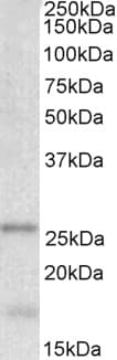 IHC-plus™ TPPP Antibody (aa21-35)