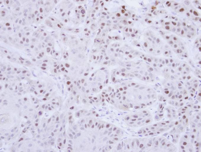 Polyclonal Rabbit anti-Human RAD18 Antibody (aa1-259, IHC, WB)