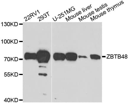 Polyclonal Rabbit anti-Human ZBTB48 / HKR3 Antibody (IHC, WB)
