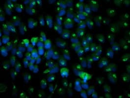 MGLL / Monoacylglycerol Lipase Antibody (clone OTI2G8)