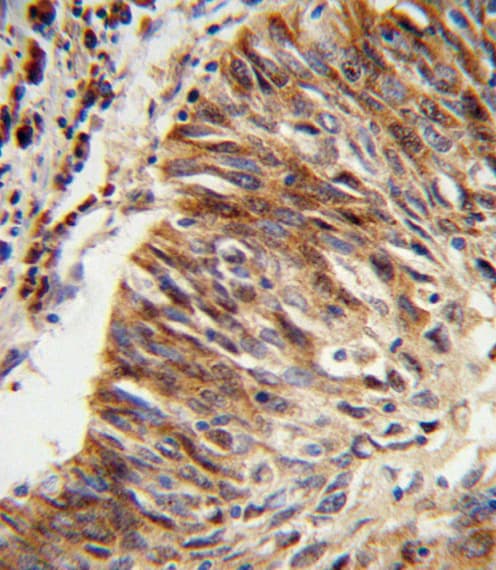 Polyclonal Rabbit anti-Human ALDH3B1 Antibody (aa334-360, IHC, WB)