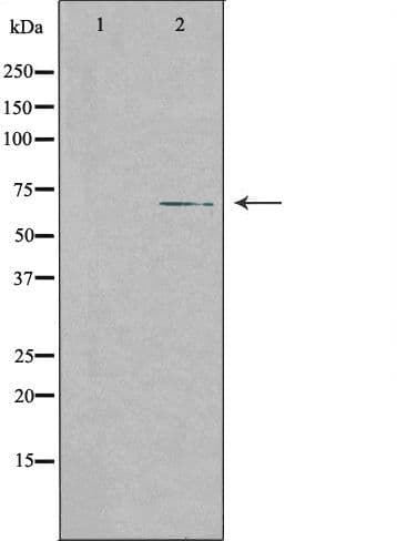 Polyclonal Rabbit anti-Human SLC28A2 Antibody (IHC, IF, WB)