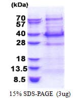 Human BCL7C Protein (Recombinant His)