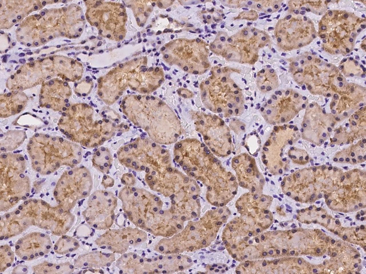 Polyclonal Rabbit anti-Human TRIAP1 Antibody (IHC, IF)
