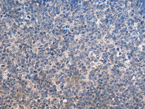 Polyclonal Rabbit anti-Human HSPA5 / GRP78 / BiP Antibody (IHC, WB)