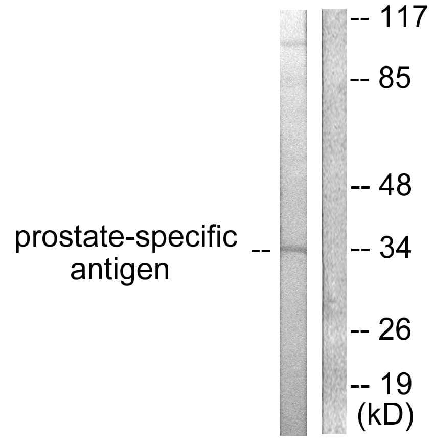 KLK3 / PSA Antibody (aa81-130)