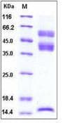 Human TGFB1 / TGF Beta 1 Protein (Recombinant His,C-terminus)