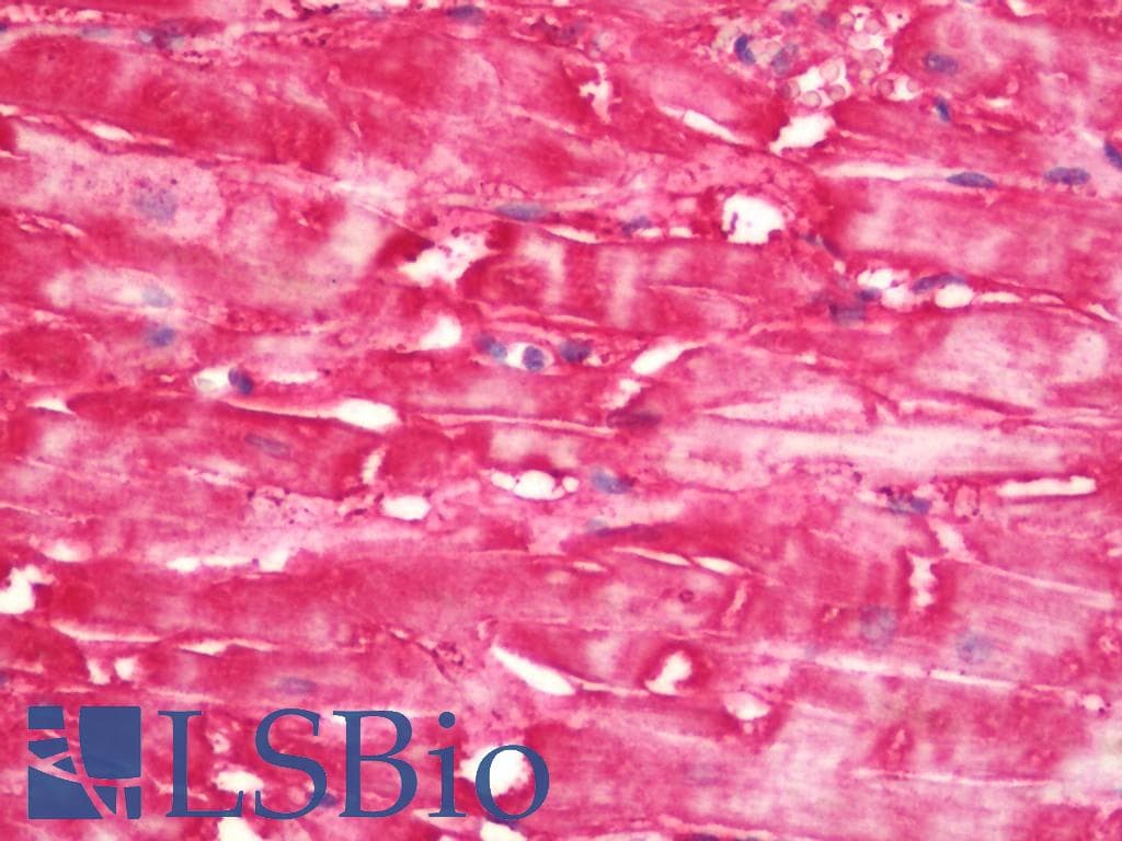 IHC-plus™ Polyclonal Rabbit anti-Human ADAM29 Antibody (IHC, IF, WB)