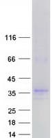 Human SYNPR / Synaptoporin Protein (Recombinant Myc-DDK (Flag))