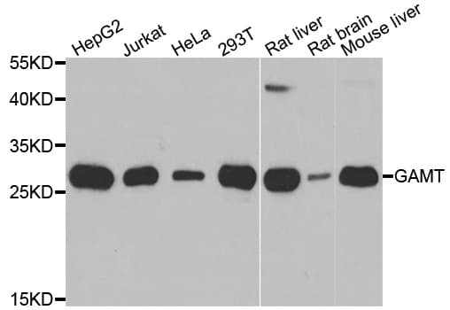 Polyclonal Rabbit anti-Human GAMT Antibody (IHC, IF, WB)