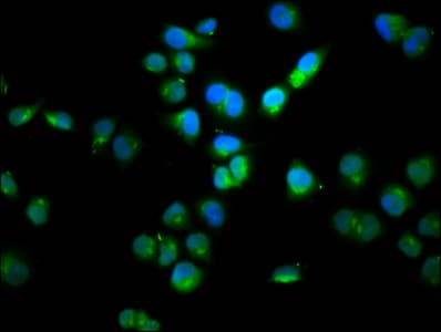 Polyclonal Rabbit anti-Human SSH1 Antibody (IHC, IF)
