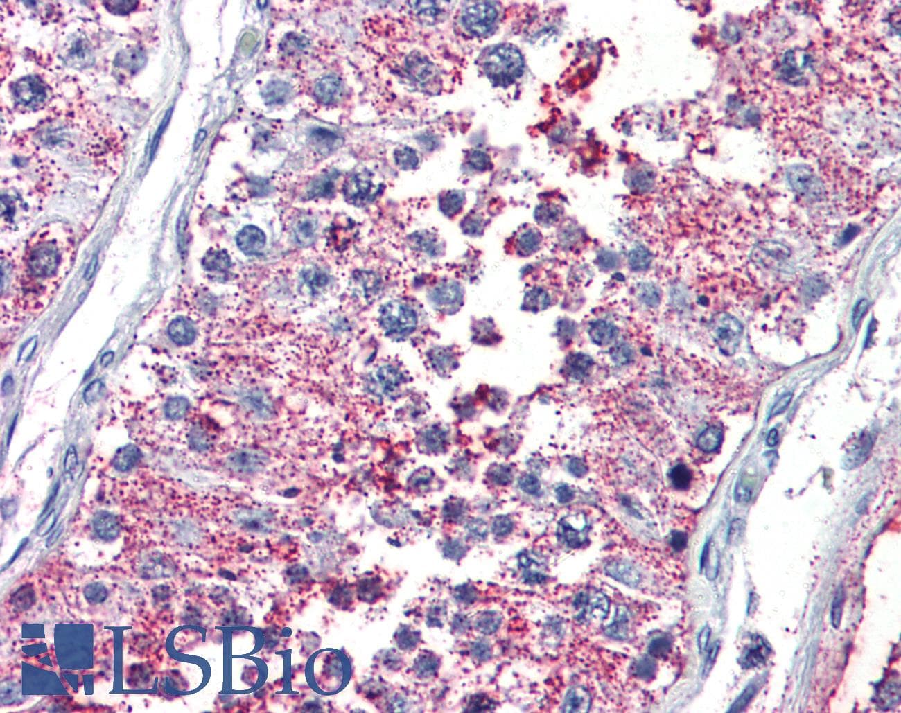 IHC-plus™ PRKCZ / PKC-Zeta Antibody (Cytoplasmic Domain)